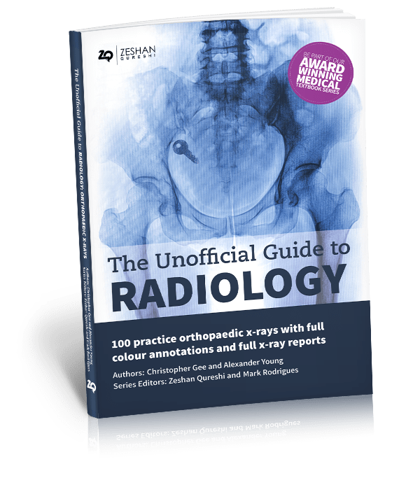 Unofficial Guide to Radiology- 100 Practice Orthopaedic X-Rays, with Full Colour