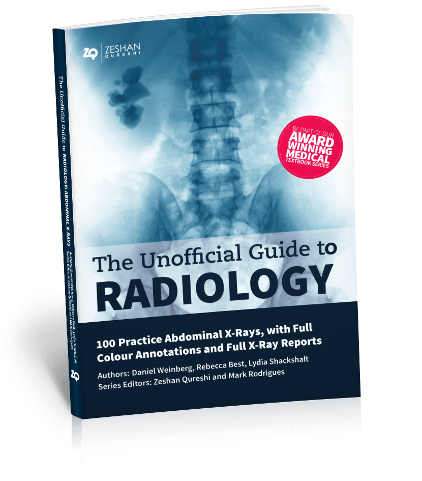 Unofficial Guide to Radiology- 100 Practice Abdominal X-Rays, with Full Colouur