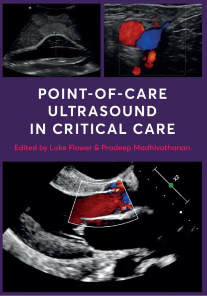 Point-Of-Care Ultrasound in Critical Care