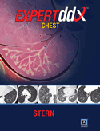 Expert Differential Diagnoses: Chest