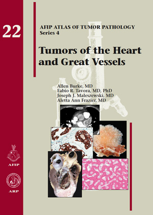 Atlas of Tumor Pathology, 4th Series, Fascicle 22- Tumors of the Heart & Great Vessels