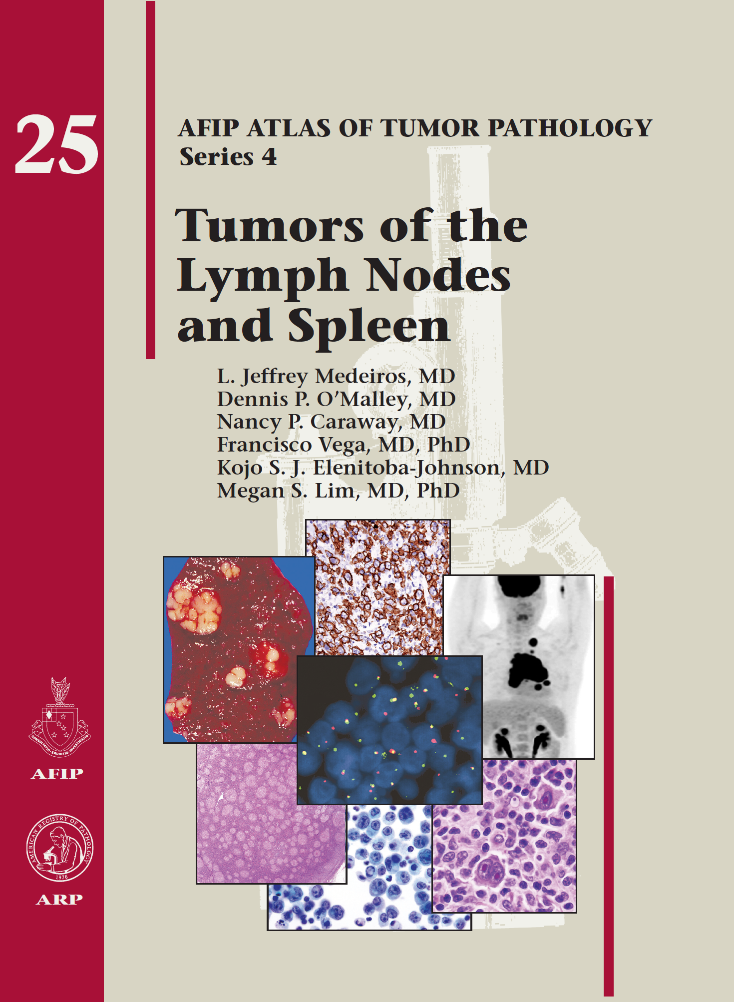 Atlas of Tumor Pathology, 4th Series, Fascicle 25- Tumors of the Lymph Node & Spleen