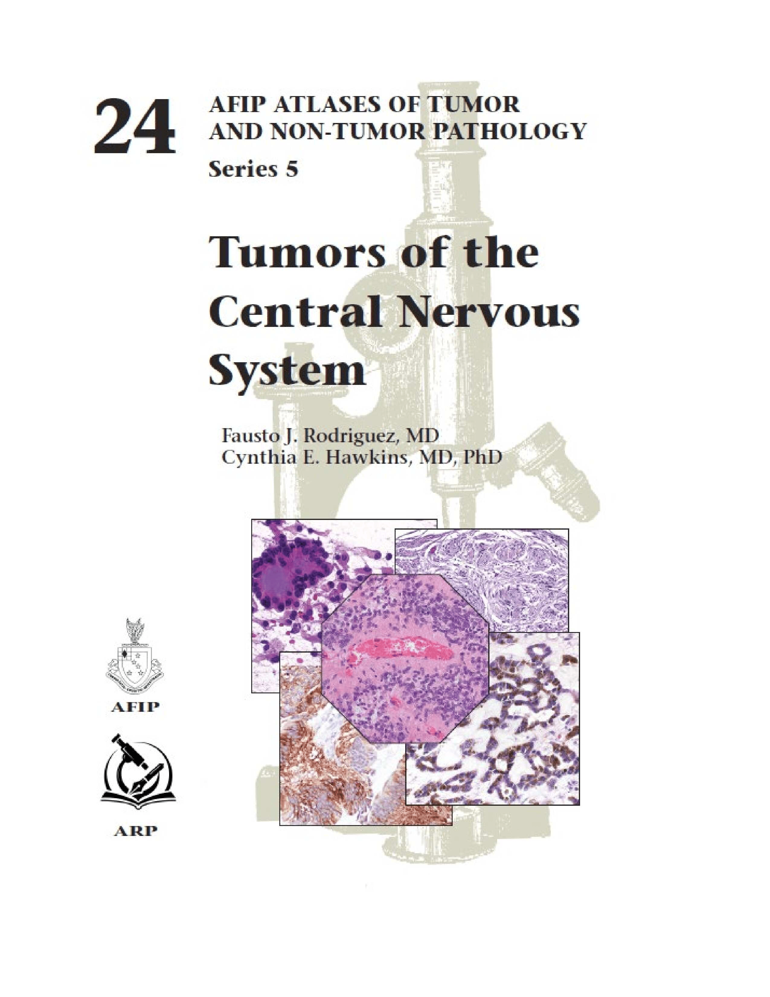 Atlases of Tumor & Non-Tumor Pathology, 5th Series,Fascicle 24