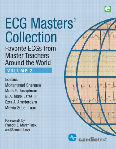 ECG Master's Collection, Vol.2- Favorite ECGs from Master Teachers Around the World