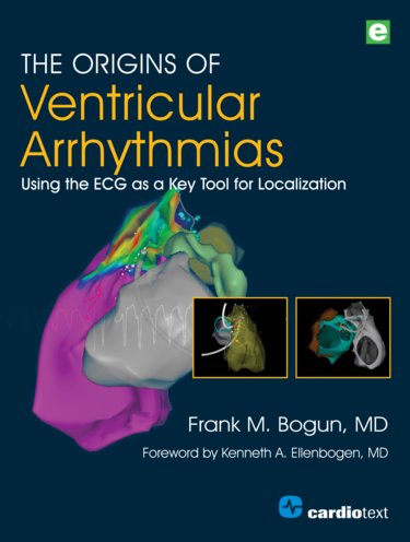 Origins of Ventricular Arrhythmias- Using the ECG as a Key Tool for Localization