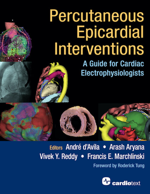 Percutaneous Epicardial Interventions- A Guide for Cardiac Electrophysiologists