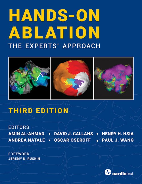 Hands-On Ablation, 3rd ed.- Experts' Approach
