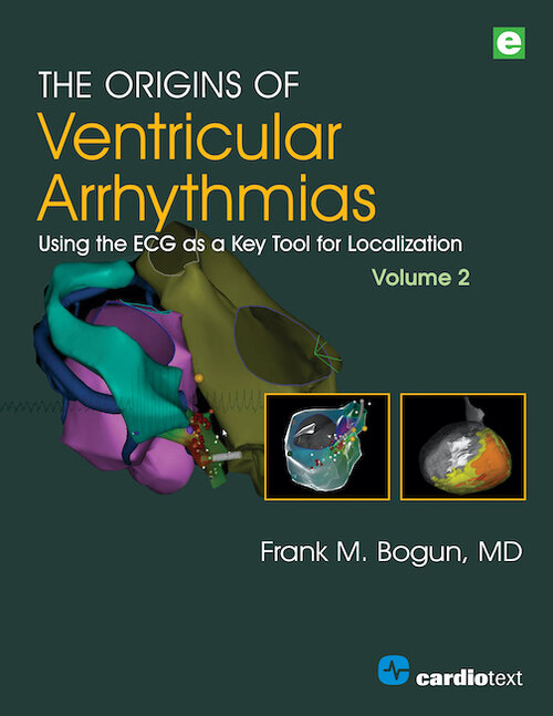 Origins of Ventricular Arrhythmias, Vol.2- Using the ECG as a Key Tool for Localization