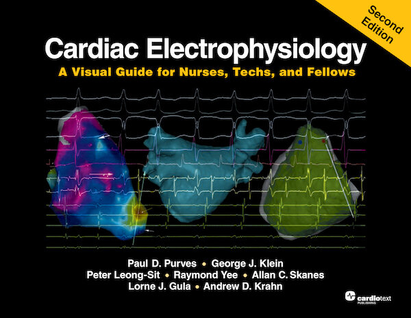 Cardiac Electrophysiology, 2nd ed.- A Visual Guide for Nurses, Techs, & Fellows