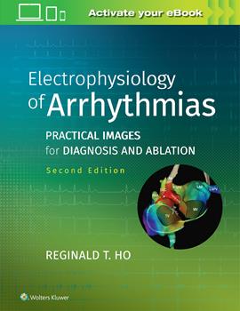 Electrophysiology of Arrhythmias, 2nd ed.- Practical Images for Diagnosis & Ablation