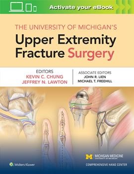 University of Michigan's Upper Extremity FractureSurgery