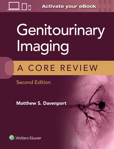 Genitourinary Imaging, 2nd ed.- A Core Review