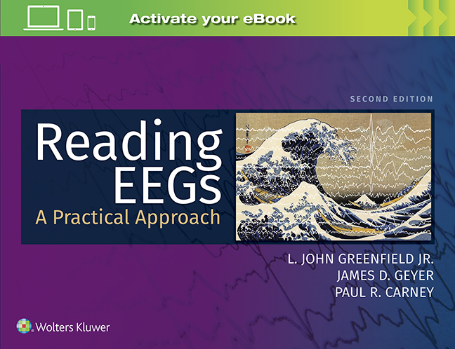Reading EEGs, 2nd ed.- A Practical Approach