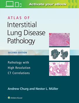 Atlas of Interstitial Lung Disease Pathology, 2nd ed.- Pathology with High Resolution CT Correlations