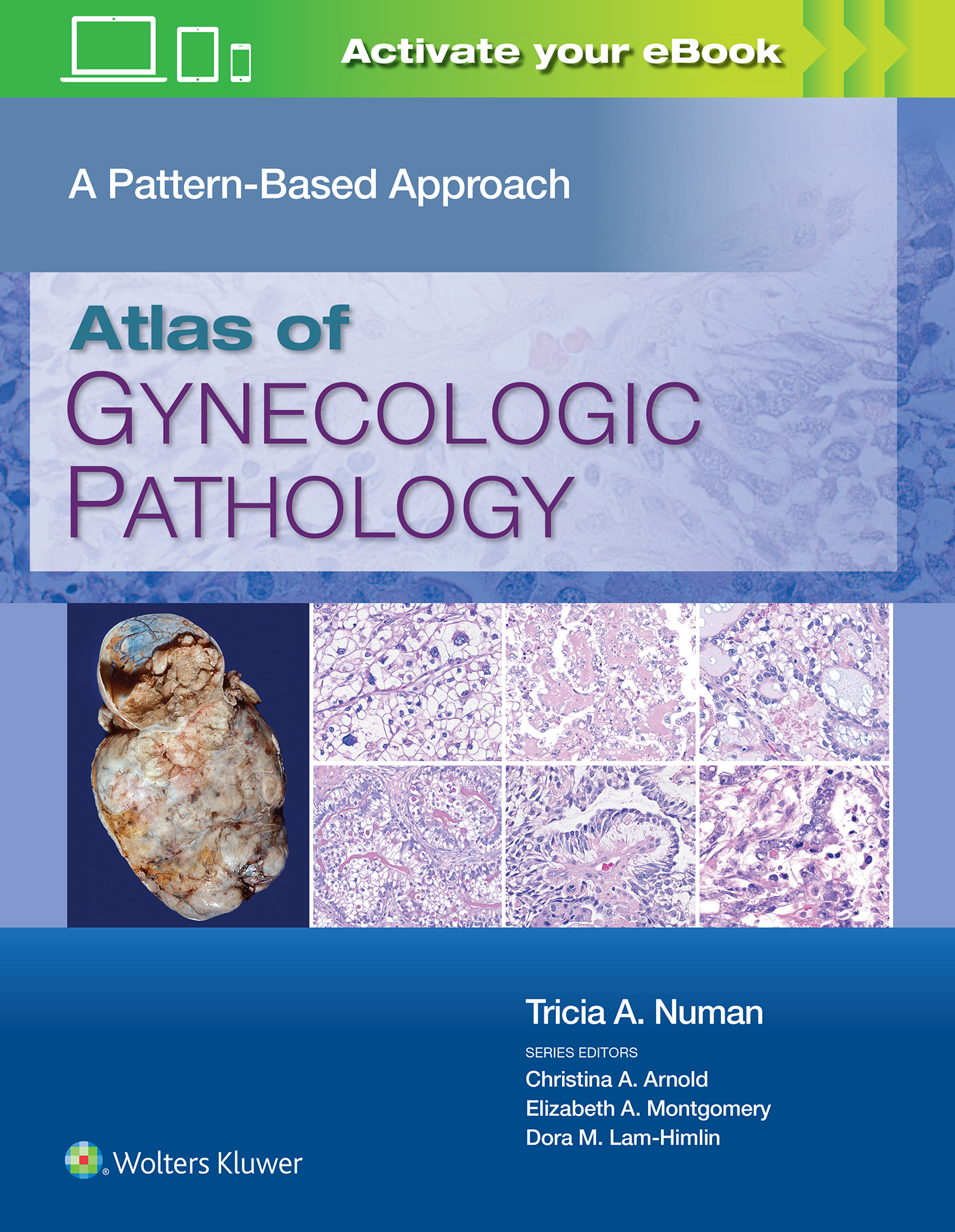 Atlas of Gynecologic Pathology- A Pattern-Based Approach