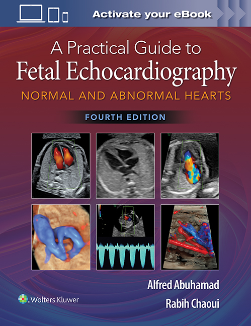 Practical Guide to Fetal Echocardiography, 4th ed.- Normal & Abnormal Hearts