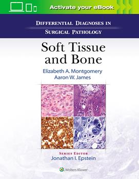 Differential Diagnoses in Surgical Pathology: SoftTissue & Bone