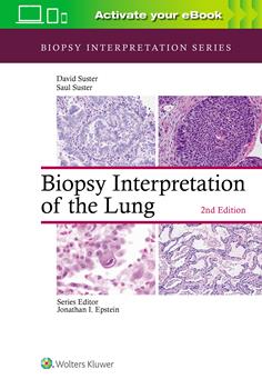 Biopsy Interpretation of the Lung, 2nd ed.