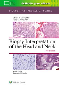 Biopsy Interpretation of the Head & Neck, 3rd ed.