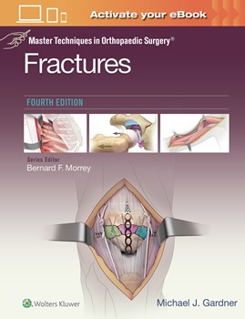 Fractures, 4th ed.(Master Techniques in Orthopaedic Surgery)
