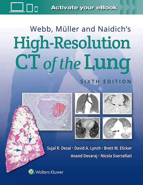 Webb, Muller & Naidich's High Resolution CT of Lung,6th ed.