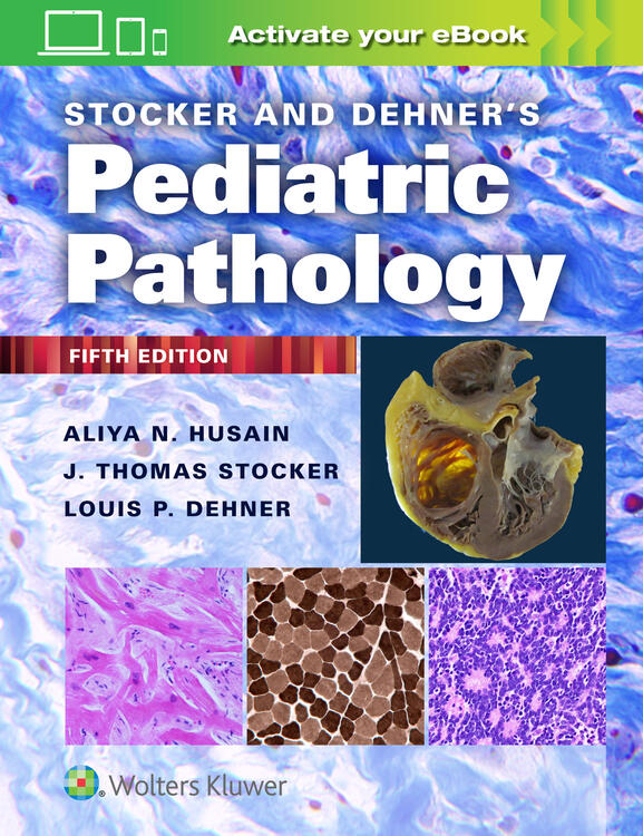 Stocker & Dehner's Pediatric Pathology, 5th ed.