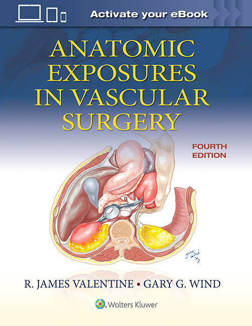 Anatomic Exposures in Vascular Surgery, 4th ed.