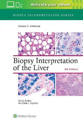 Biopsy Interpretation of the Liver, 4th ed.