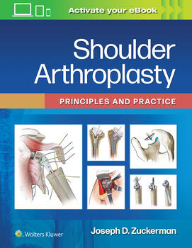 Shoulder ArthroplastyPrinciples & Practice