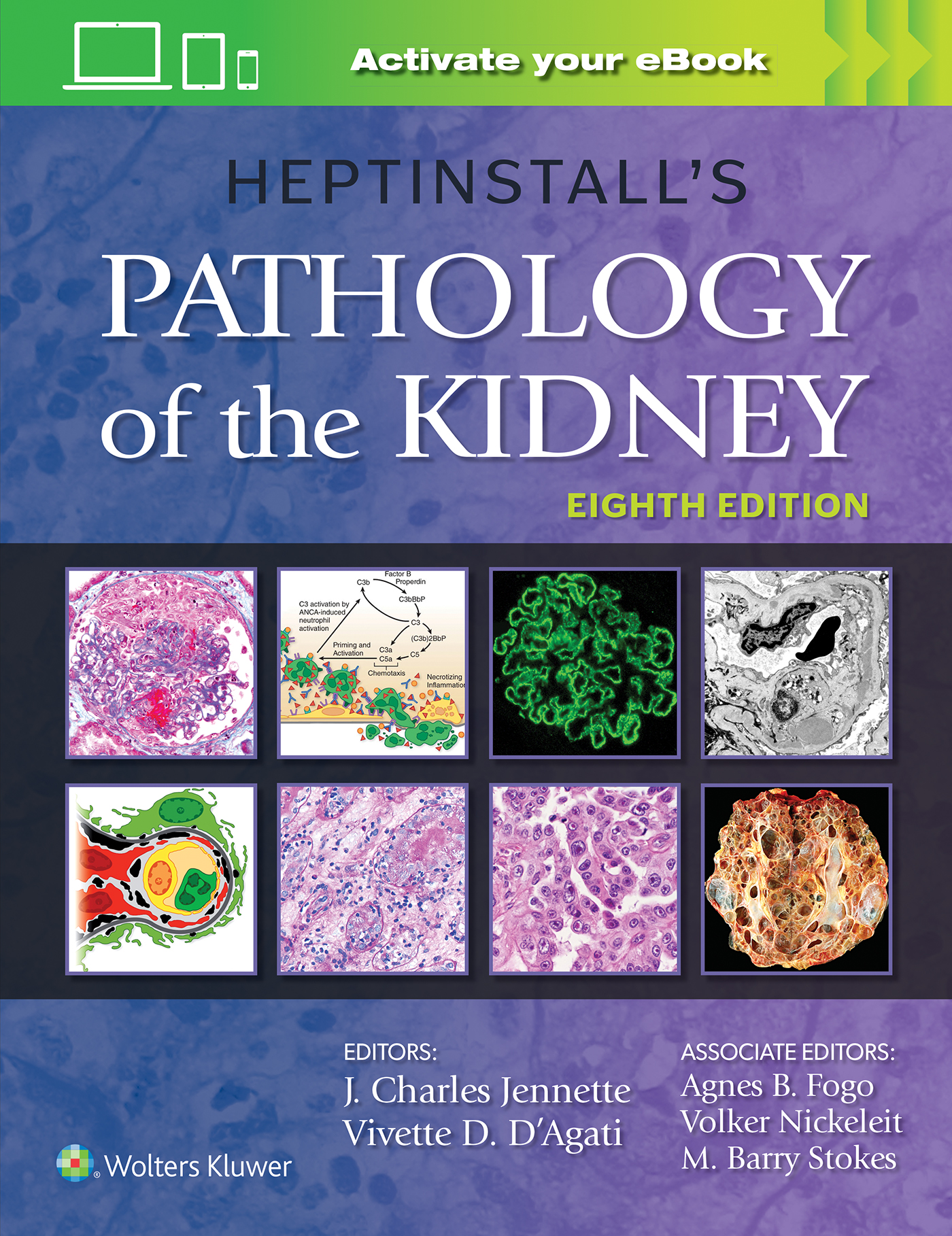 Heptinstall's Pathology of the Kidney, 8th ed.