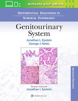 Differential Diagnoses in Surgical Pathology:Genitourinary System, 2nd ed.