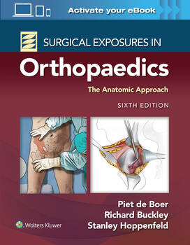 Surgical Exposures in Orthopaedics, 6th ed.- Anatomic Approach