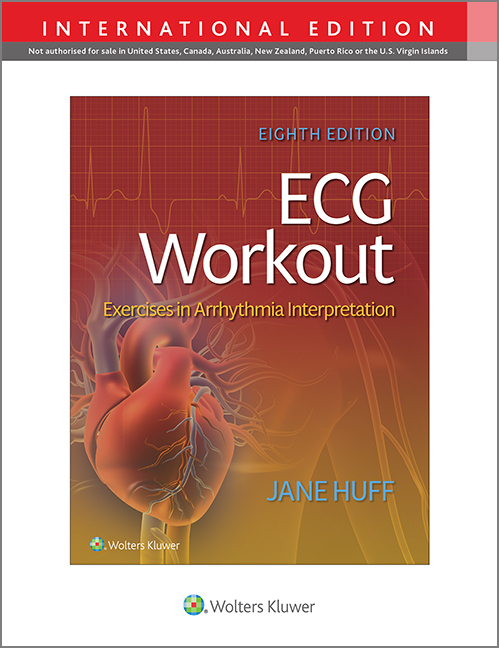 ECG Workout, 8th ed.- Exercises in Arrhythmia Interpretation