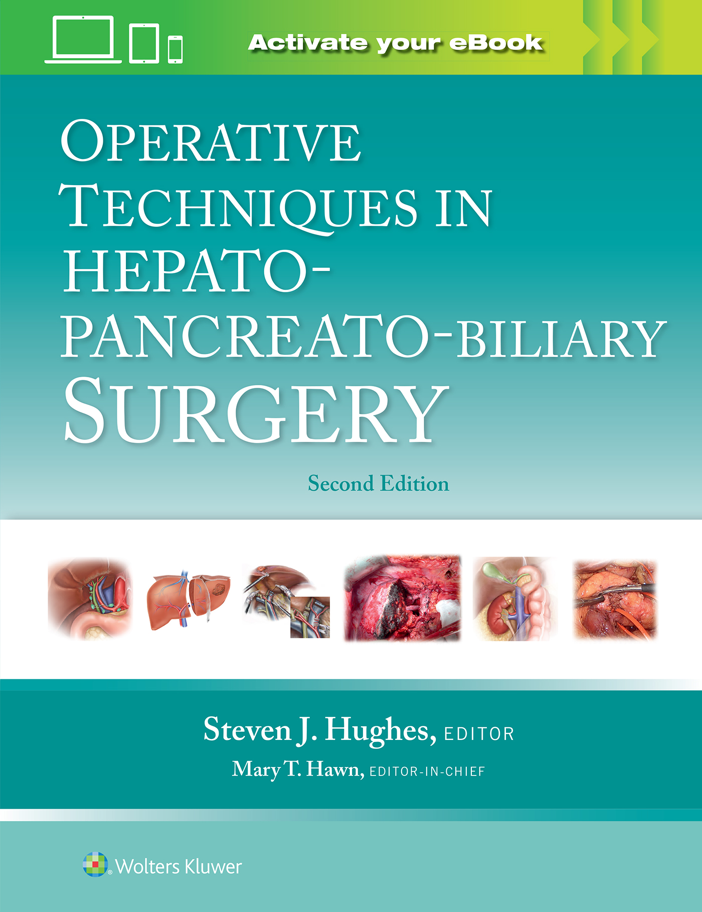 Operative Techniques in Hepato-Pancreato-BiliarySurgery, 2nd ed.