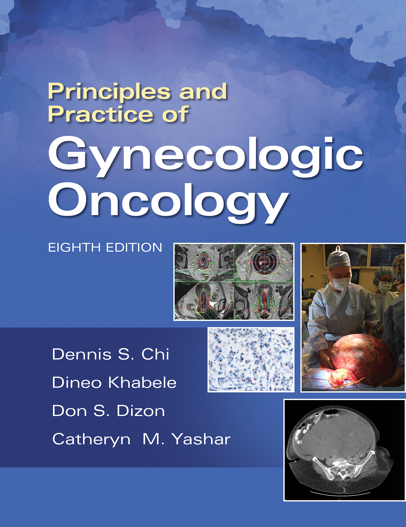 Principles & Practice of Gynecologic Oncology, 8th ed.