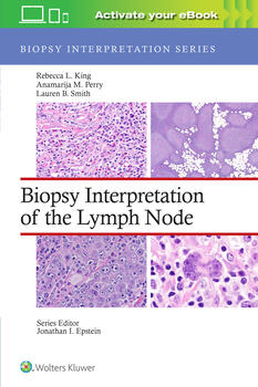Biopsy Interpretation of the Lymph Node(Biopsy Interpretation Series)