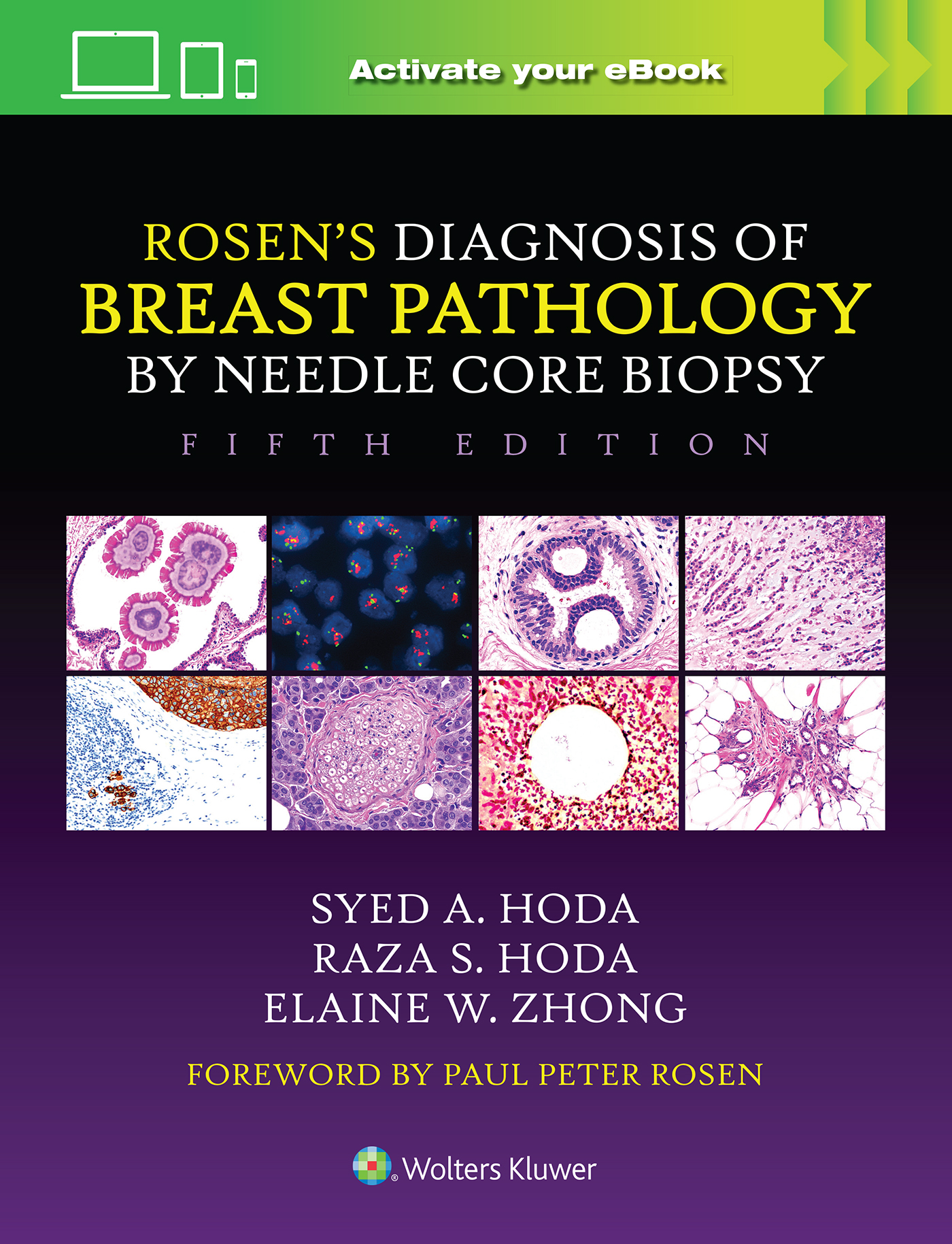 Rosen's Diagnosis of Breast Pathology by Needle CoreBiopsy, 5th ed.