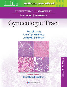 Differential Diagnoses in Surgical Pathology:Gynecologic Tract, 2nd ed.