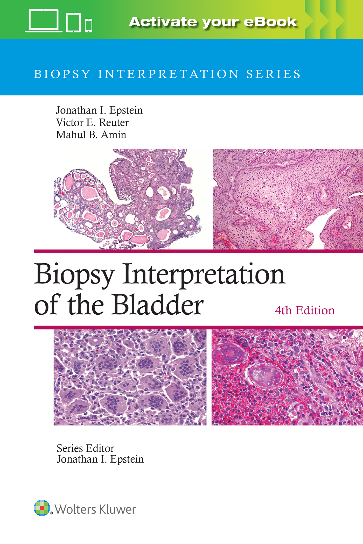 Biopsy Interpretation of the Bladder, 4th ed.(Biopsy Interpretation Series)