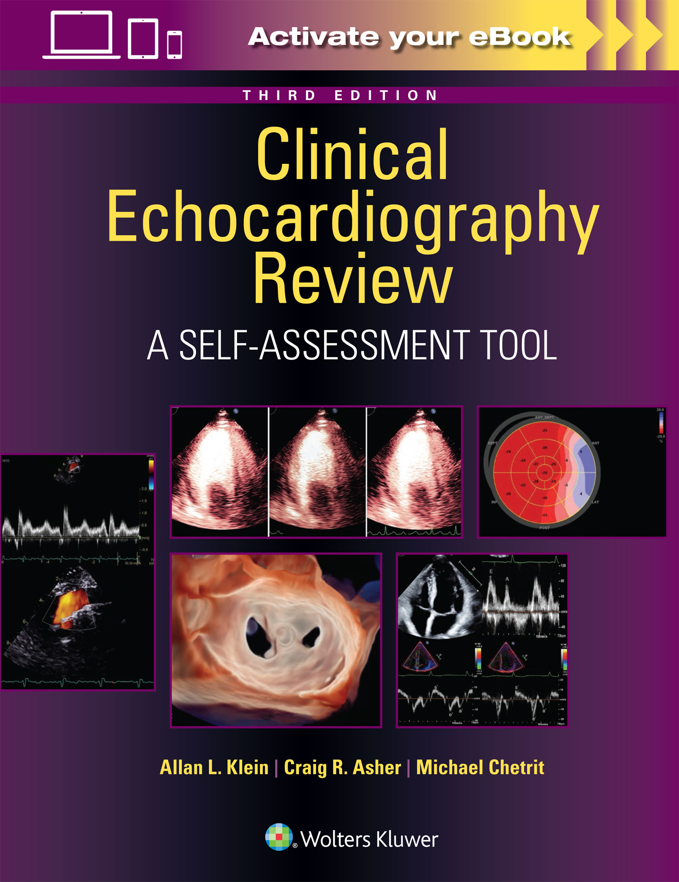 Clinical Echocardiography Review, 3rd ed.- A Self-Assessment Tool