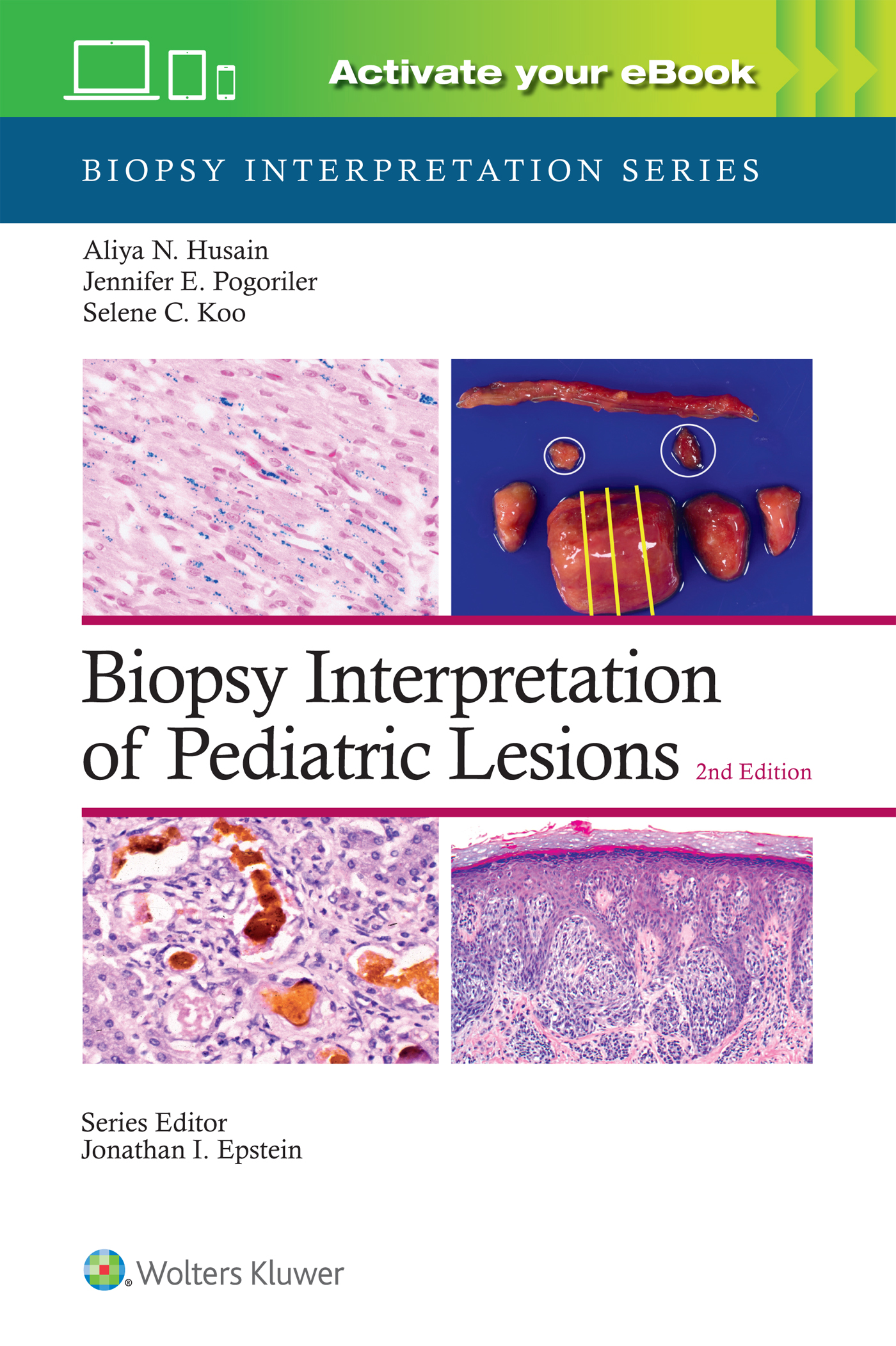 Biopsy Interpretation of Pediatric Lesions, 2nd ed.(Biopsy Interpretation Series)