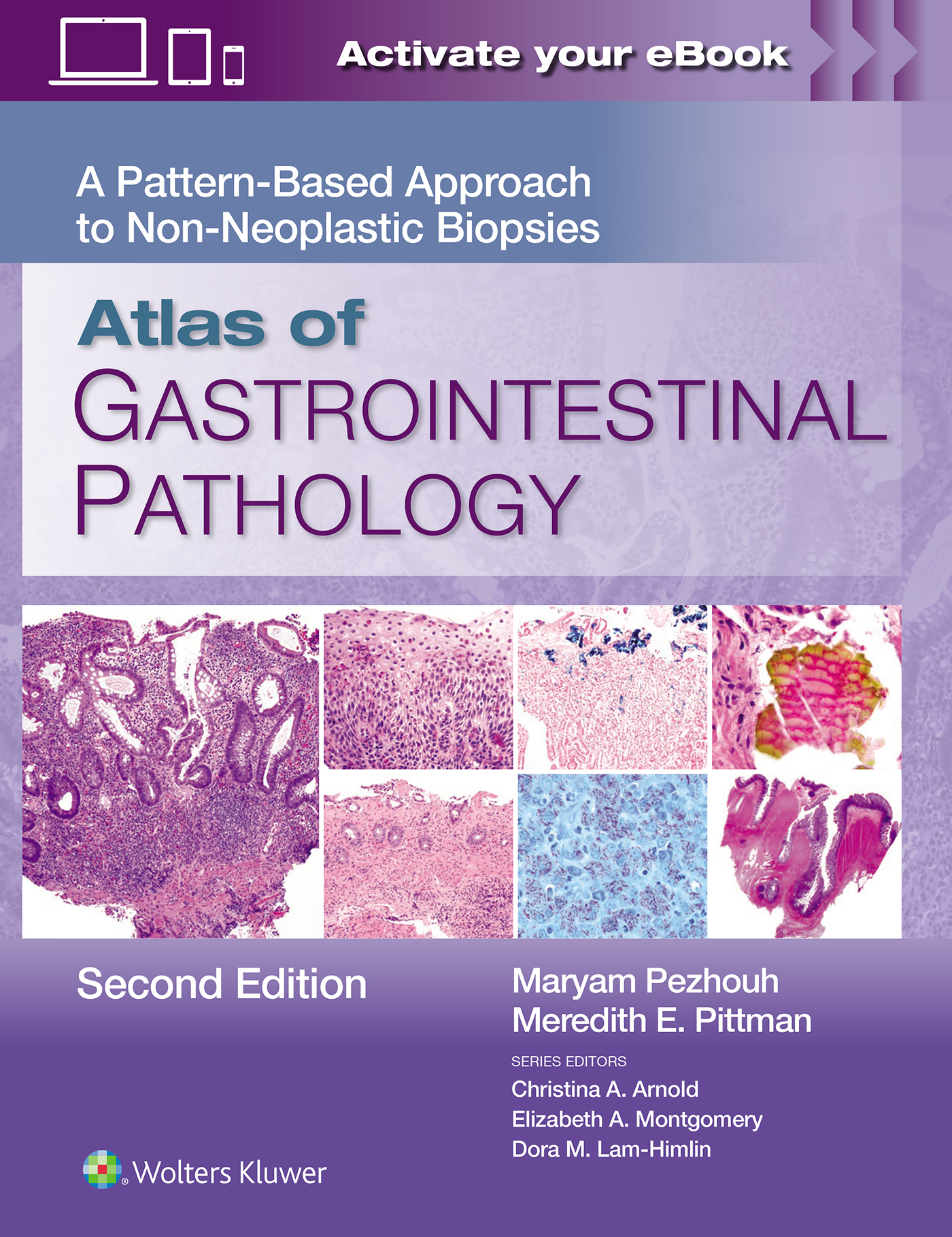 Atlas of Gastrointestinal Pathology, 2nd ed.- A Pattern Based Approach to Non-Neoplastic Biopsies