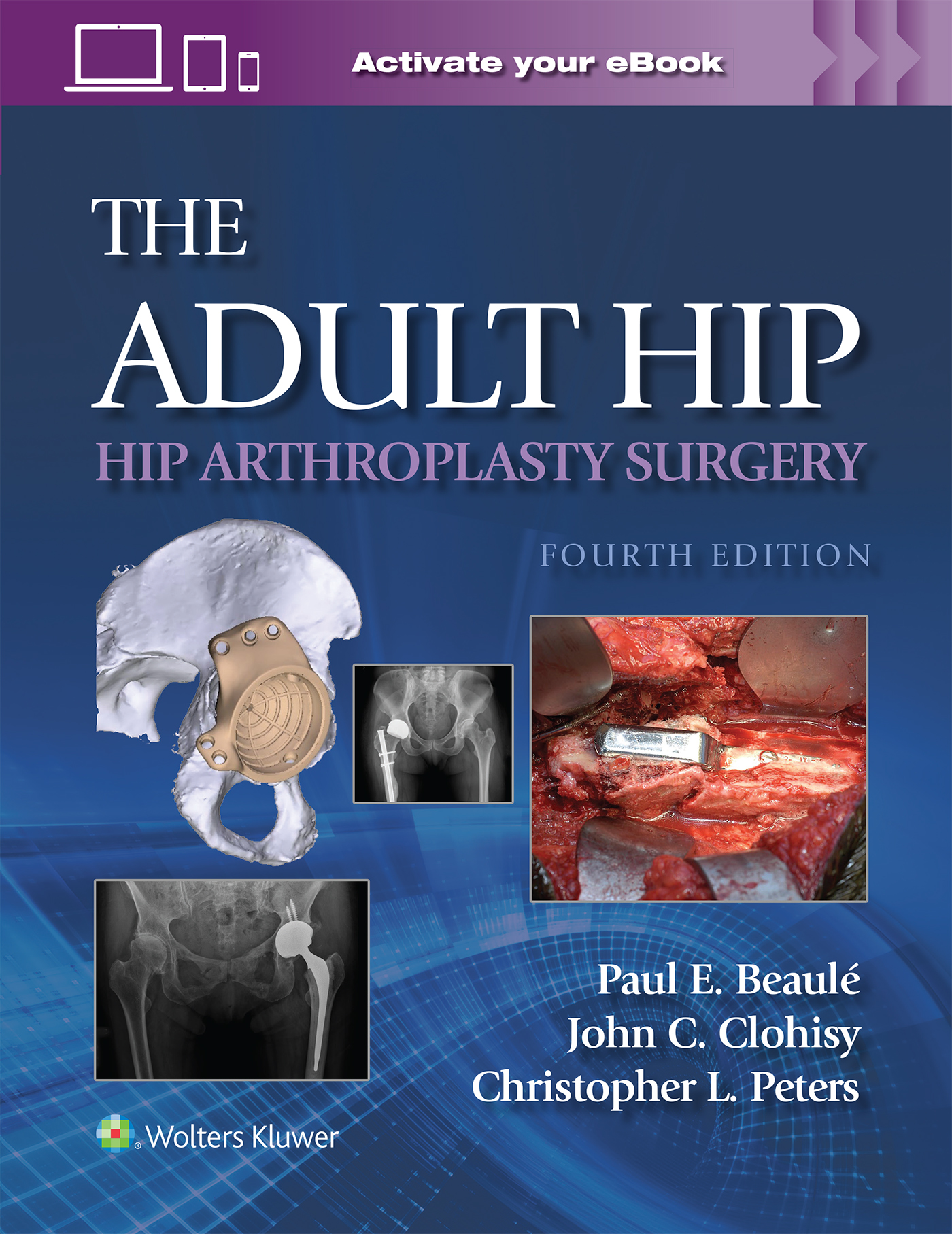 Adult Hip, 4th ed.- Hip Arthroplasty Surgery