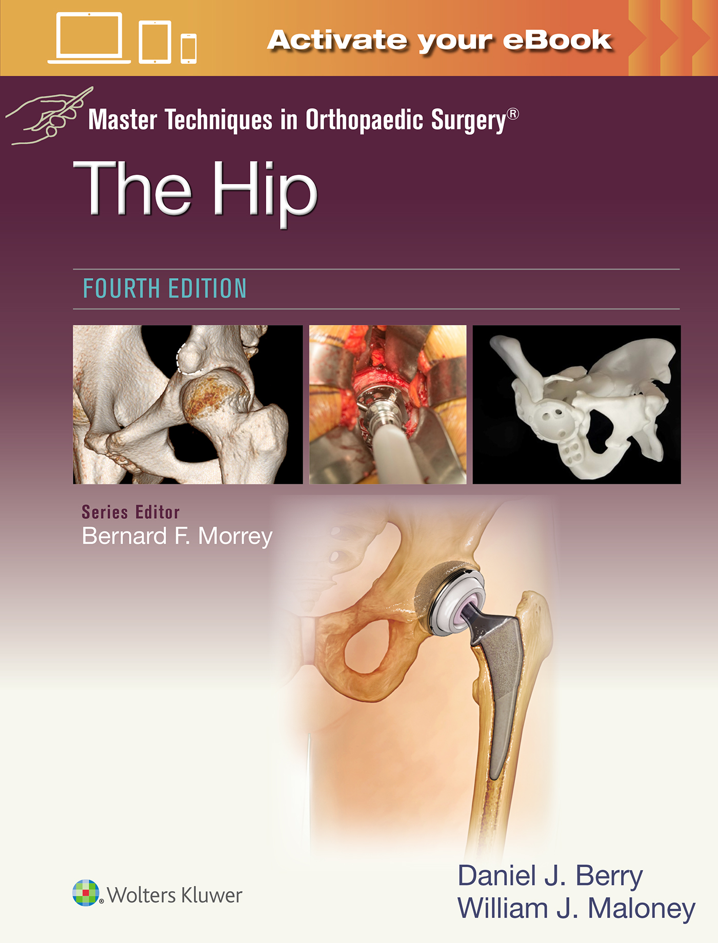 Hip, 4th ed.(Master Techniques in Orthopaedic Surgery)