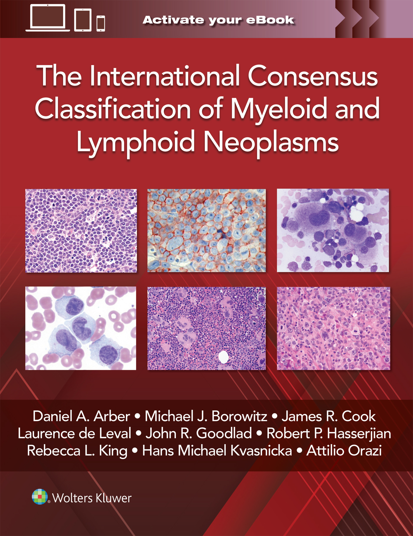 International Consensus Classification of Myeloid &Lymphoid Neoplasms