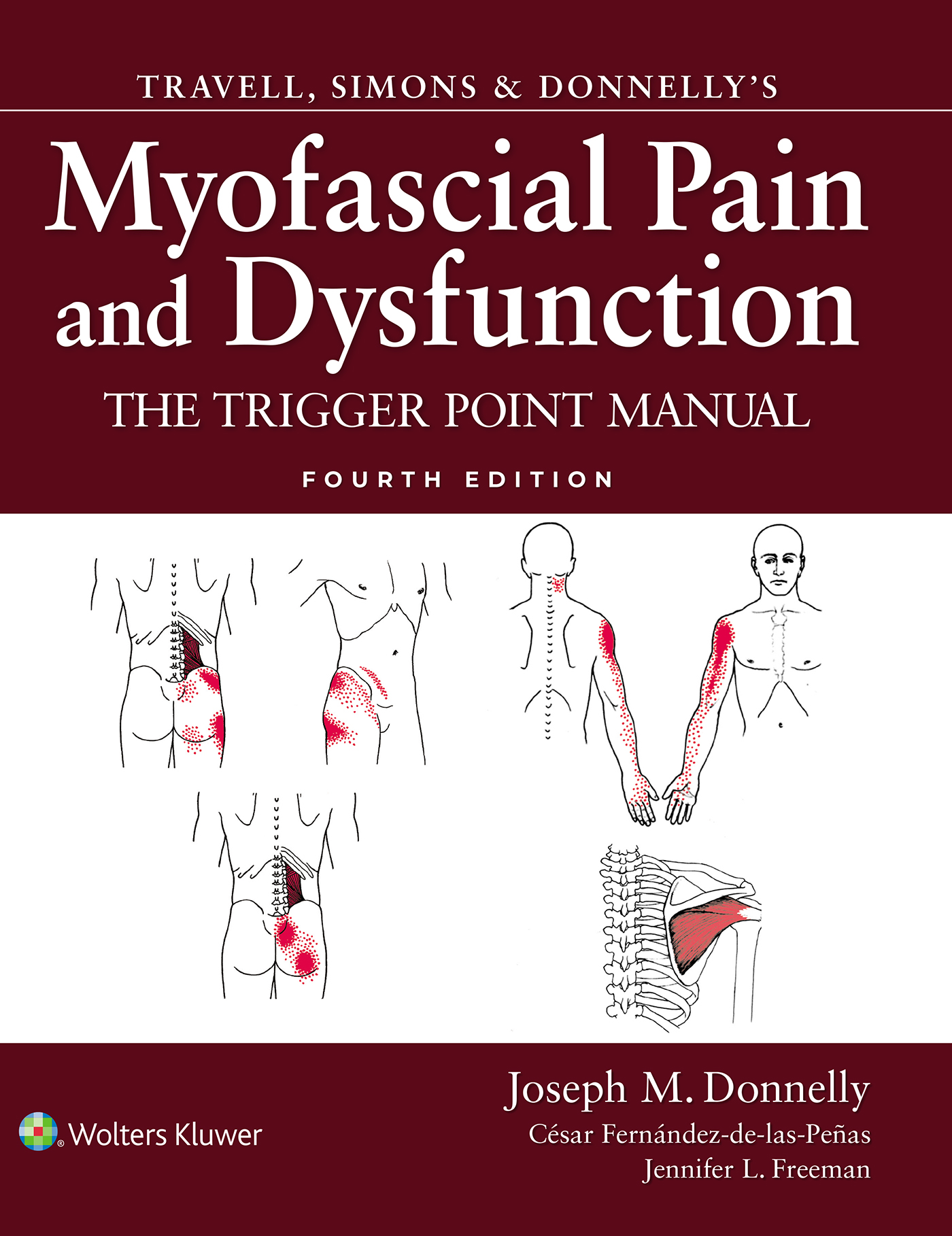 Travell, Simons & Donnelly's Myofascial Pain& Dysfunction, 4th ed.