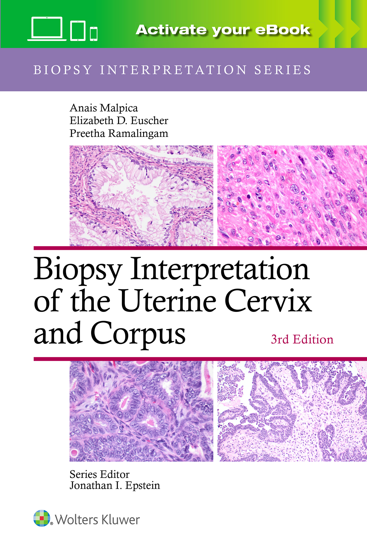 Biopsy Interpretation of Uterine Cervix & Corpus,3rd ed.
