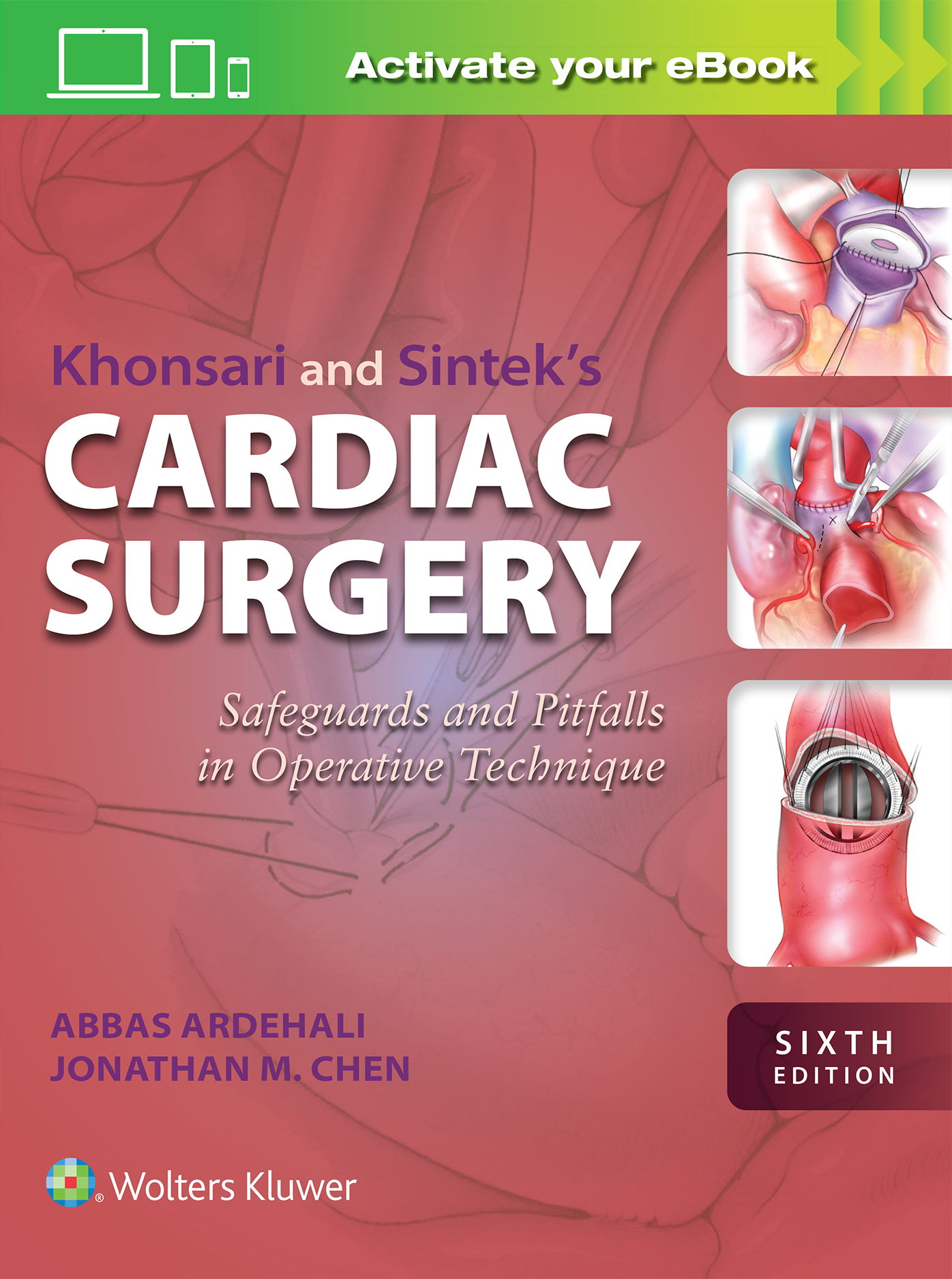 Khonsari & Sintek's Cardiac Surgery, 6th ed.- Safeguards & Pitfalls in Operative Technique