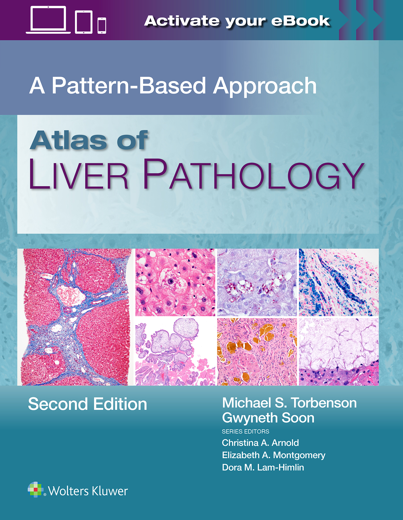 Atlas of Liver Pathology, 2nd ed.- Pattern Based Approach