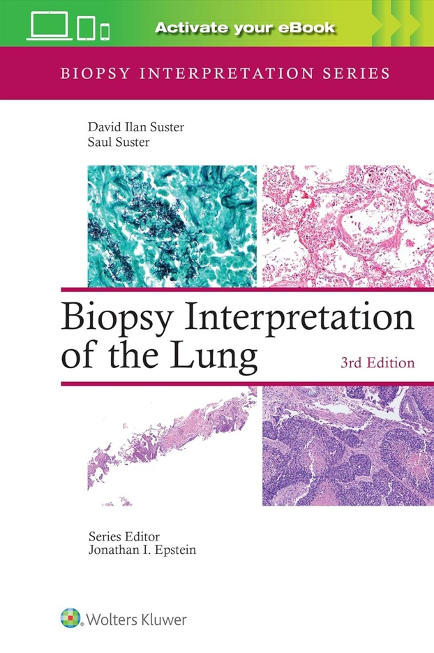 Biopsy Interpretation of the Lung, 3rd ed.